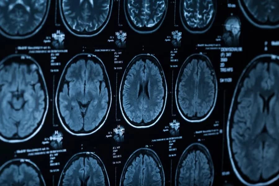 Ile się czeka na wynik tomografii głowy? Sprawdź czas oczekiwania