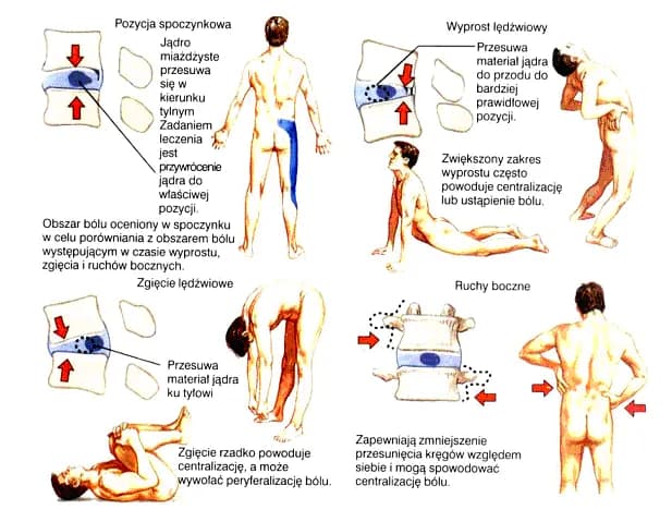 Jak wygląda rehabilitacja kręgosłupa? Poznaj skuteczne metody i etapy
