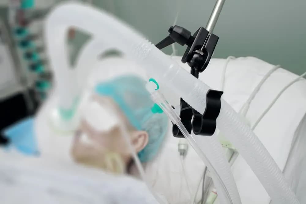 Jak długo trwa wybudzanie ze śpiączki farmakologicznej? Kluczowe informacje